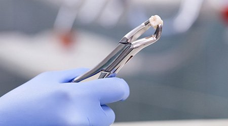 Gloved hand holding forceps grasping extracted tooth