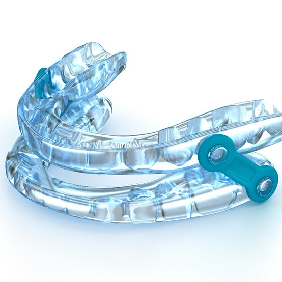 An oral sleep appliance