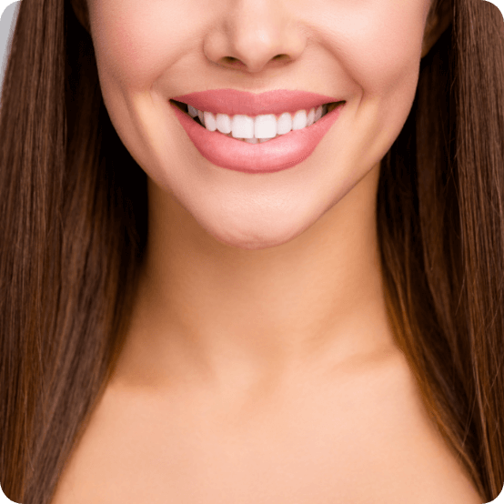 Closeup of flawless smile after porcelain veneers cosmetic dentistry