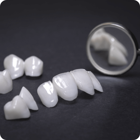 Metal free dental crowns and bridges prior to placement