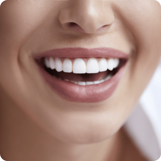 Closeup of bright smile after teeth whitening