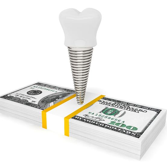 Dental implant on a pile of money