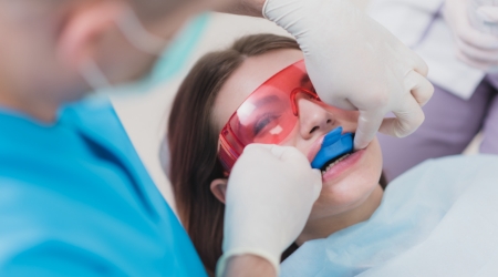 Dental patient receiving in office fluoride treatment
