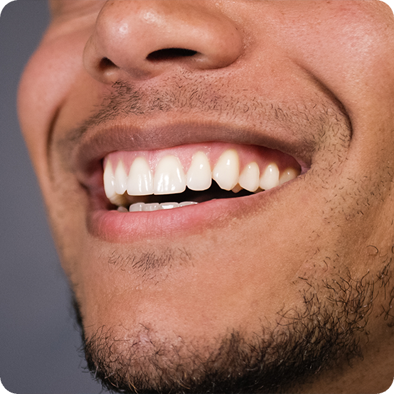 Closeup of healthy smile after antibiotic therapy