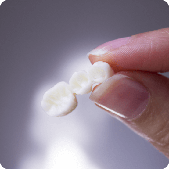 Hand holding a dental bridge