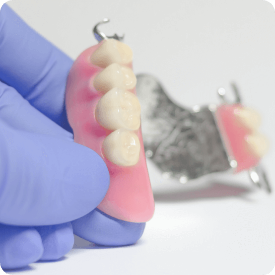 Hand holding partial dentures