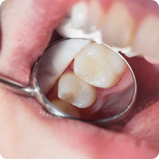 Dentist examining a smile after restorative dentistry in Eugene